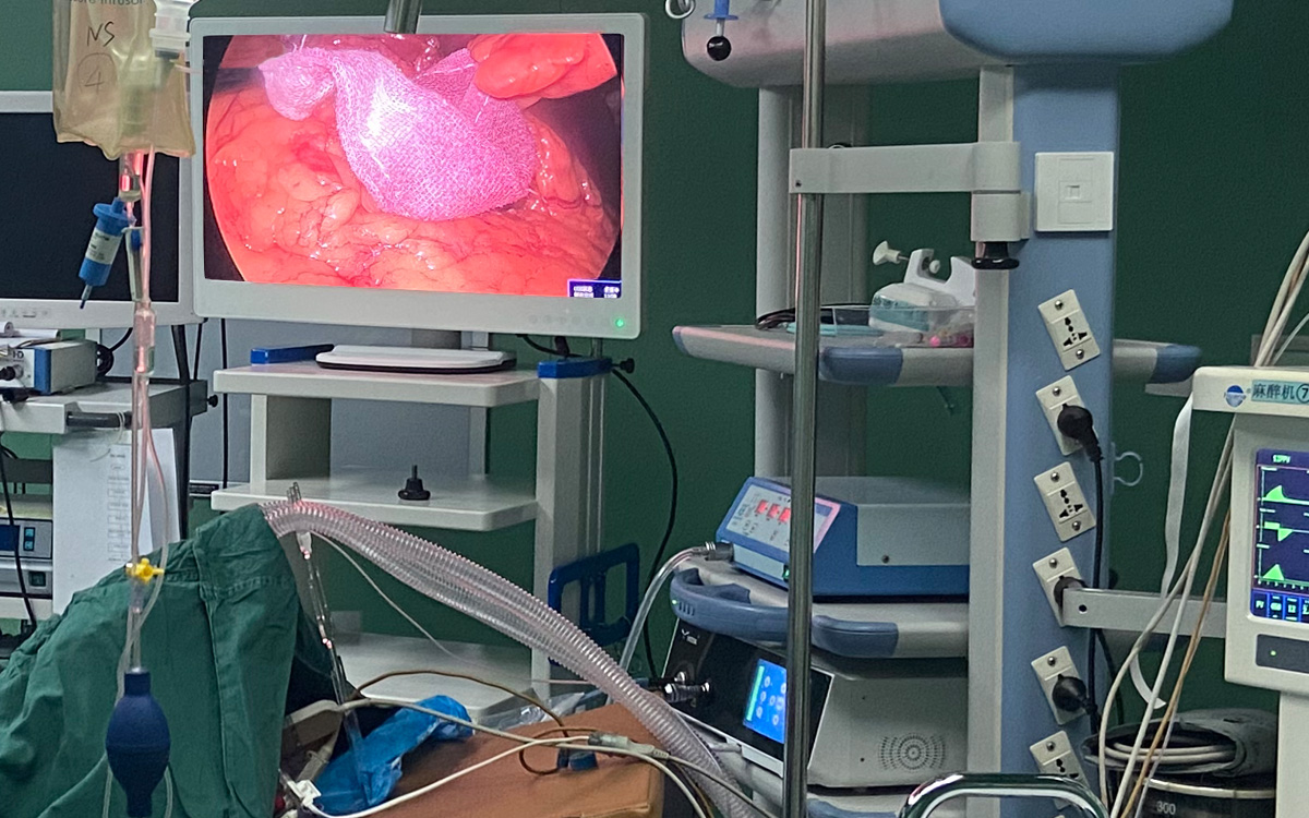 益柯達4K超高清內(nèi)窺鏡攝像機臨床手術應用