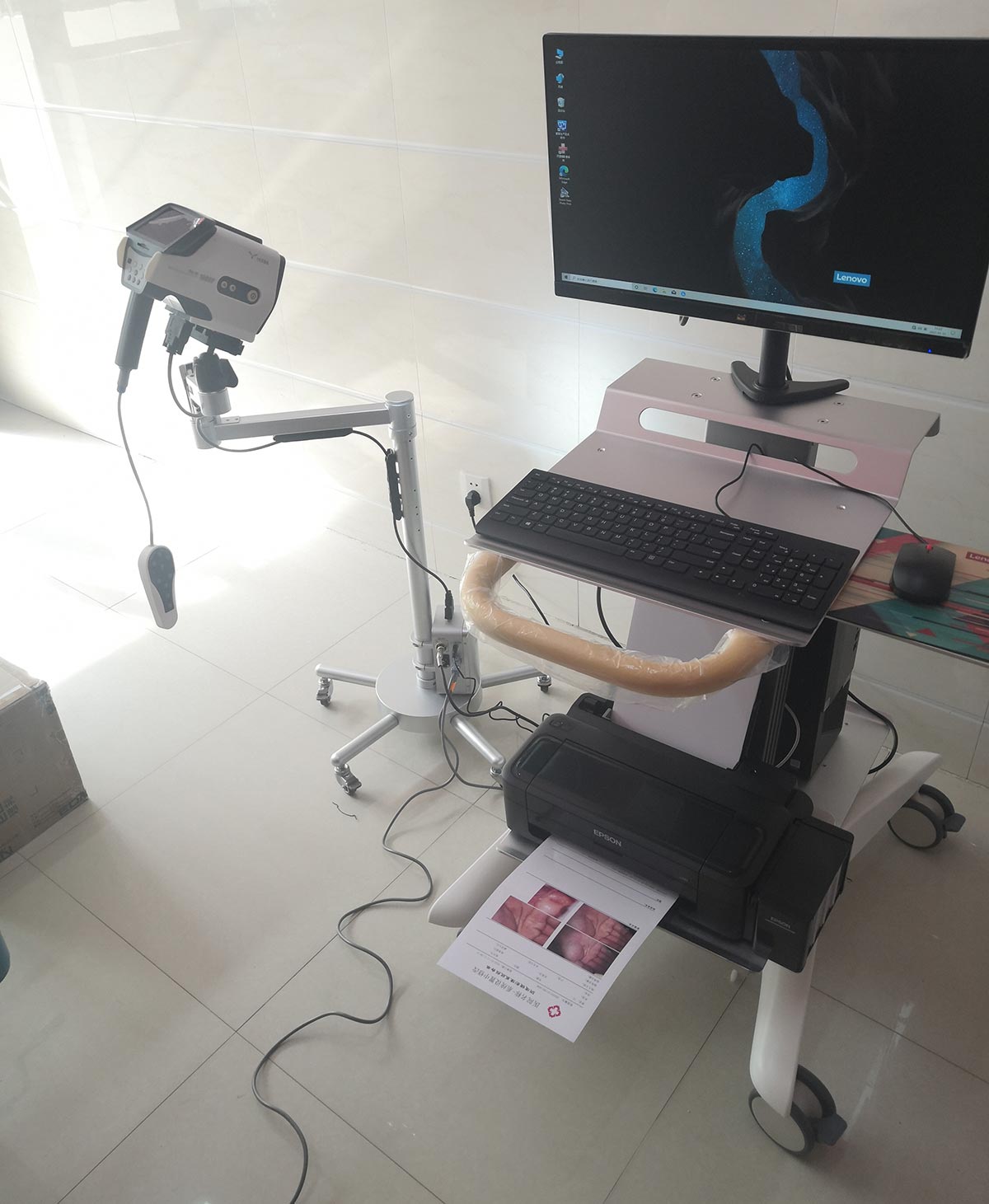 益柯達(dá)YKD-3001數(shù)碼電子陰道鏡裝機