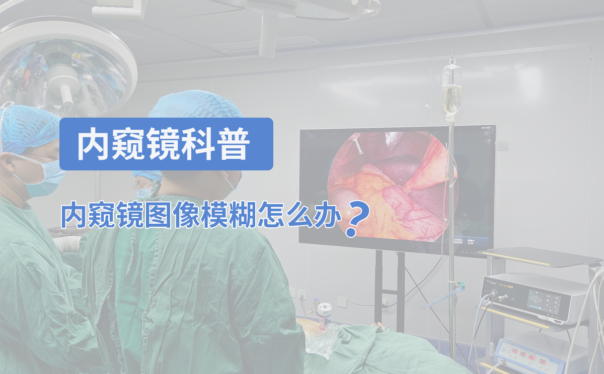 內(nèi)窺鏡科普：內(nèi)窺鏡圖像模糊怎么辦？
