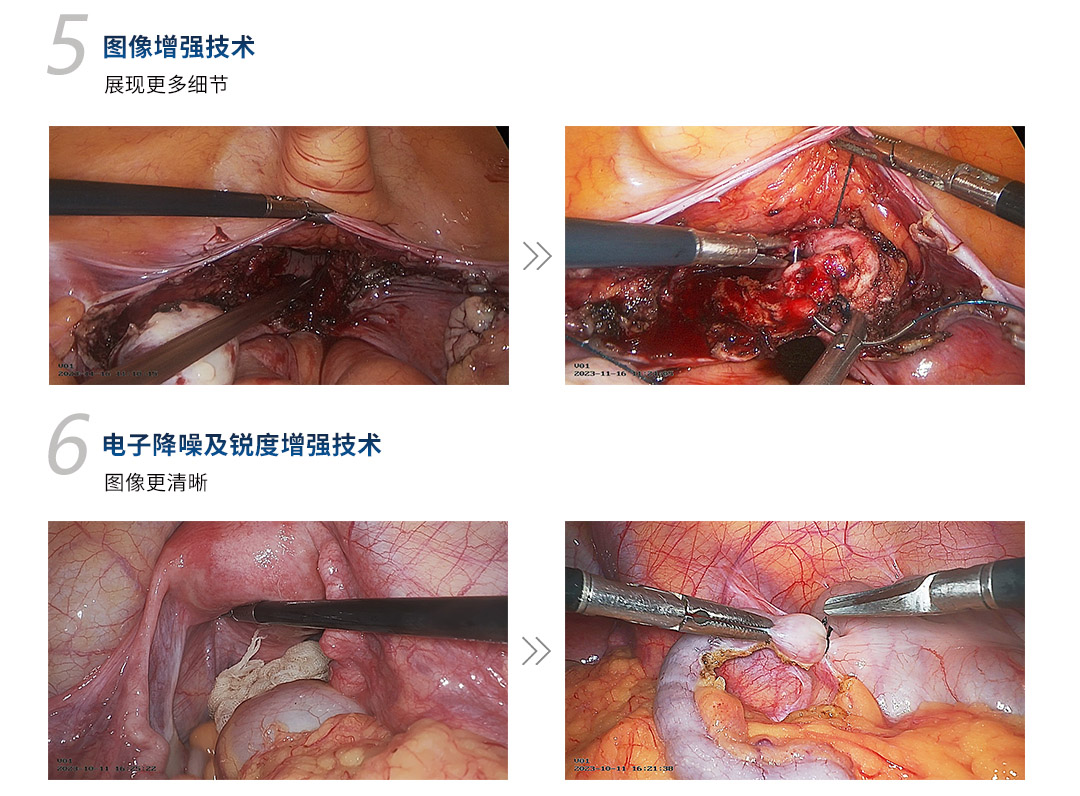 4K醫(yī)用內窺鏡攝像系統(tǒng) YKD-9211