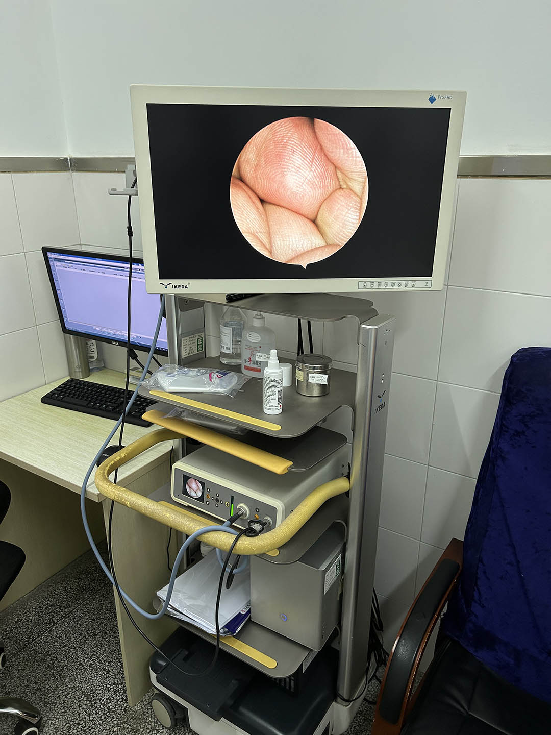 醫用內窺鏡攝像系統