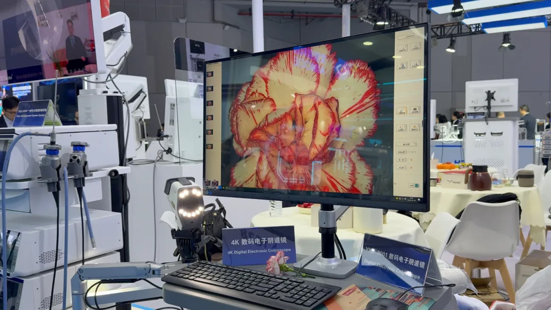 4K數碼電子陰道鏡