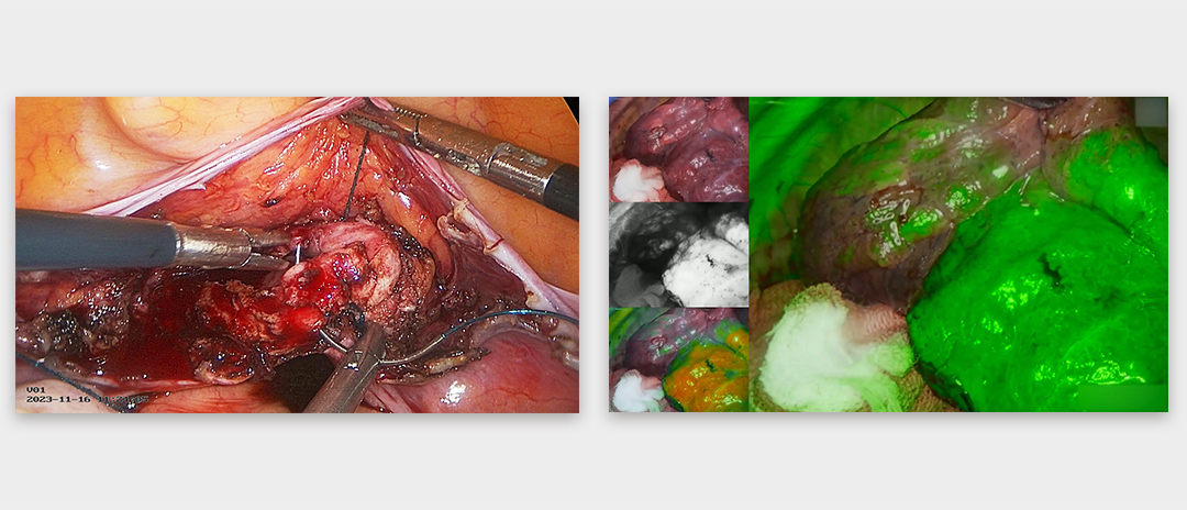 4K熒光內窺鏡攝像系統