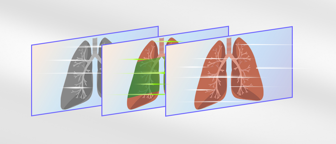 4K熒光內窺鏡攝像系統