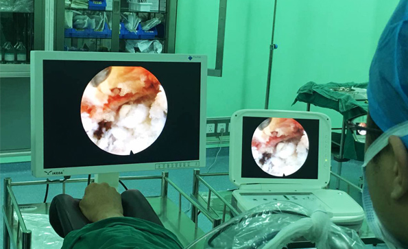 如何維護(hù)保養(yǎng)內(nèi)窺鏡顯示器？