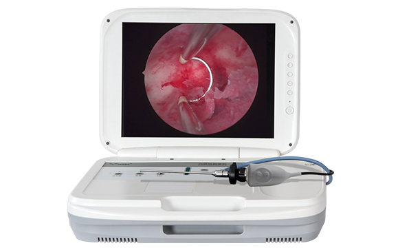 醫(yī)用內窺鏡攝像系統(tǒng)一體機安裝