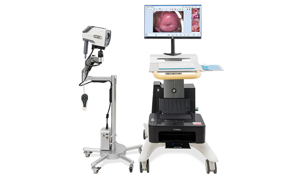 婦科電子陰道鏡檢查的作用有哪些？