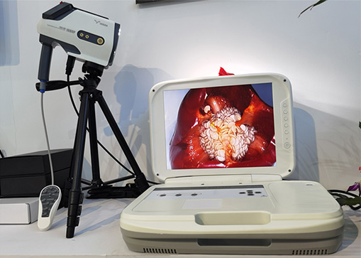 陰道鏡檢查：電子陰道鏡檢查過程疼嗎？