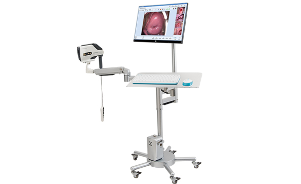 電子陰道鏡檢查結果有哪些？多長時間出結果？