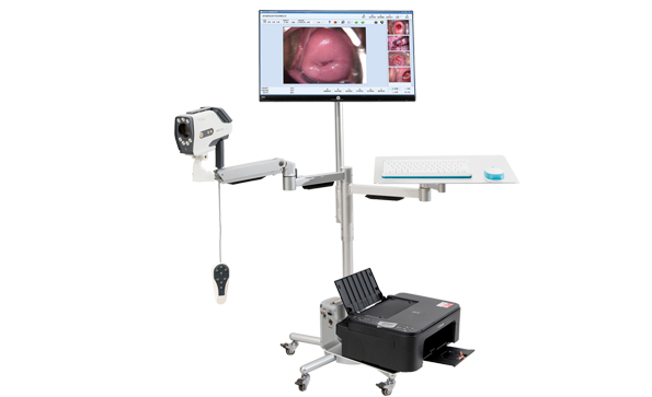 電子陰道鏡跟陰式彩超哪個看婦科炎癥比較準(zhǔn)？