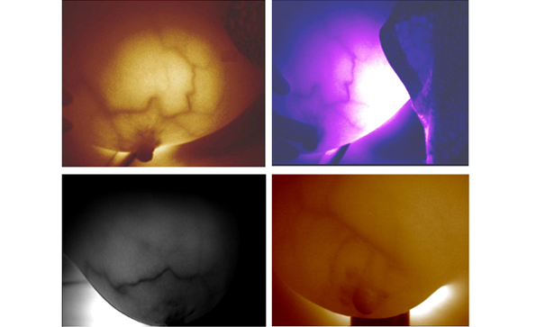 紅外乳腺檢查儀檢查乳腺準(zhǔn)嗎？如何檢查呢？