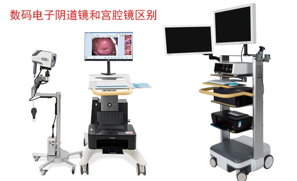 數碼電子陰道鏡和宮腔鏡檢查什么？有什么區別？