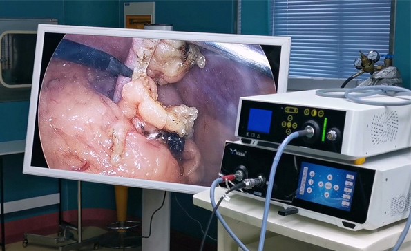 宮、腹腔鏡聯合手術在婦科的應用